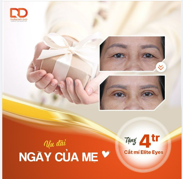 TẶNG MẸ CẮT MÍ THAY LỜI MUỐN NÓI CON YÊU MẸ