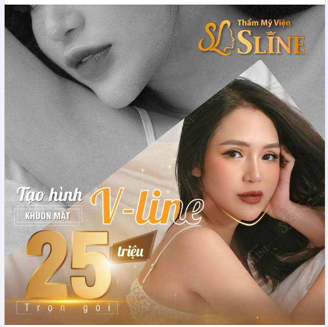 Tạo hình khuôn mặt Vline với dịch vụ Độn cằm Softform,