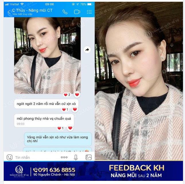 Tham khảo feedback - Bí quyết để lựa chọn được địa chỉ nâng mũi uy tín và chất lượng