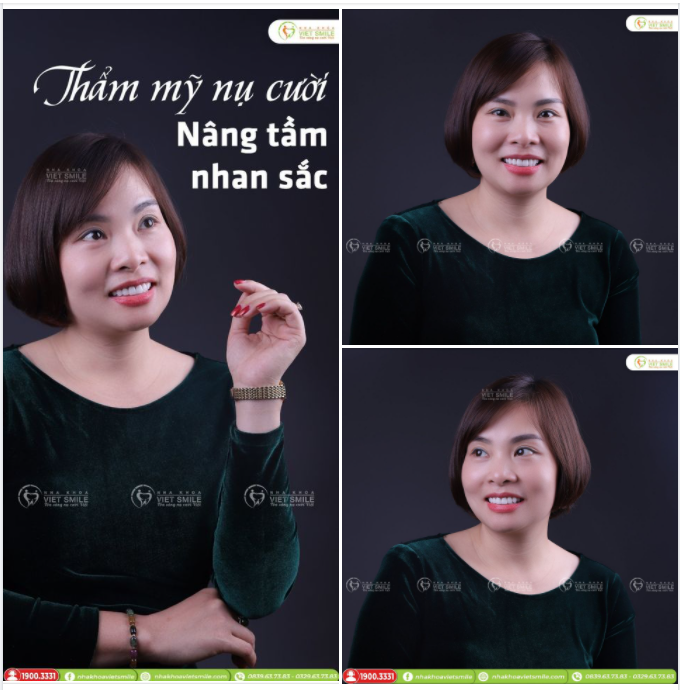 THẨM MỸ RĂNG SỨ - NÂNG TẦM NHAN SẮC