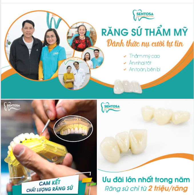 THẨM MỸ RĂNG SỨ - THAY ĐỔI DIỆN MẠO HÀM RĂNG