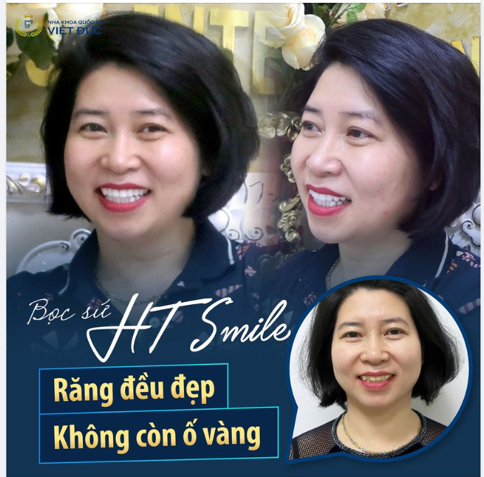 “THẬT LÀ LỰA CHỌN ĐÚNG ĐẮN KHI LỰA CHỌN NKQT VIỆT ĐỨC ĐỂ GỬI GẮM NỤ CƯỜI”