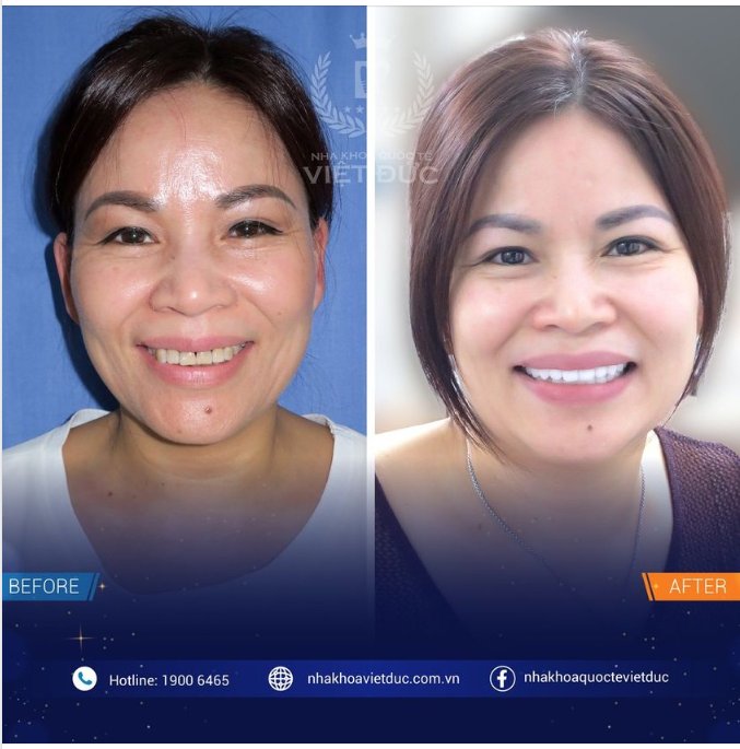 THAY ĐỔI ĐỂ HOÀN HẢO HƠN