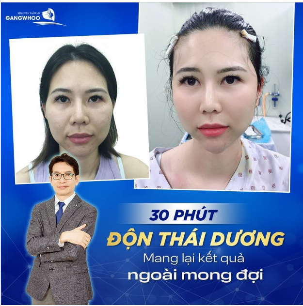 THAY ĐỔI NHAN SẮC CHỈ VỚI 30 PHÚT ĐỘN THÁI DƯƠNG