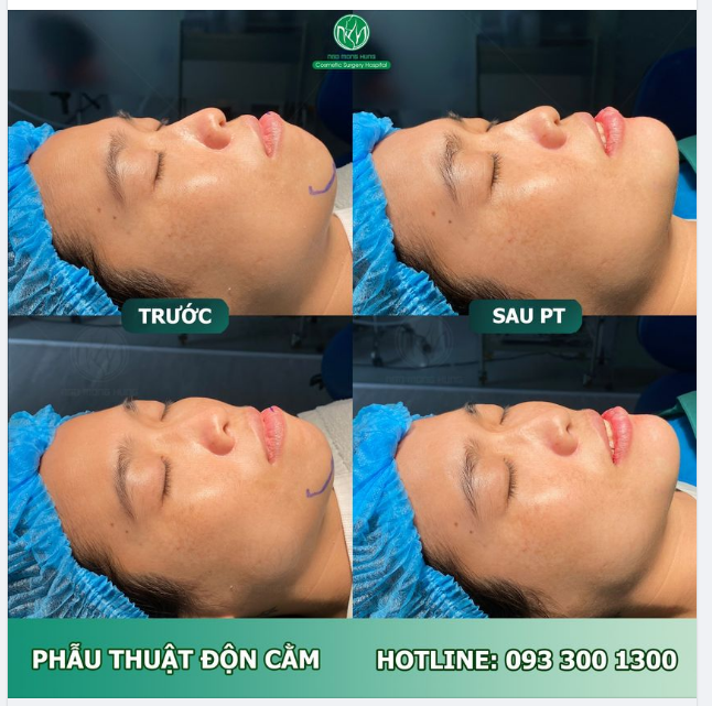 THAY ĐỔI NHỎ - KHÁC BIỆT LỚN
