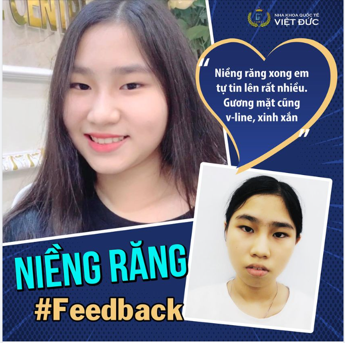 THAY ĐỔI NỤ CƯỜI - THAY ĐỔI TƯƠNG LAI
