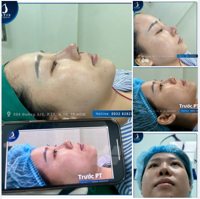 Thì ra, mùa xuân hoa nở...là vì mũi đẹp