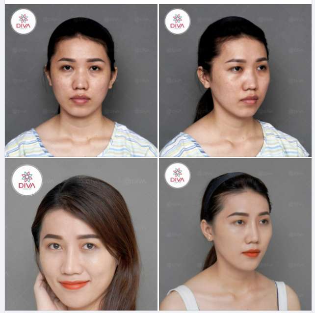 THÍCH VẺ ĐẸP MỀM MẠI, TỰ NHIÊN CÔ GÁI TÌM ĐẾN DIVA VÀ CÁI KẾT