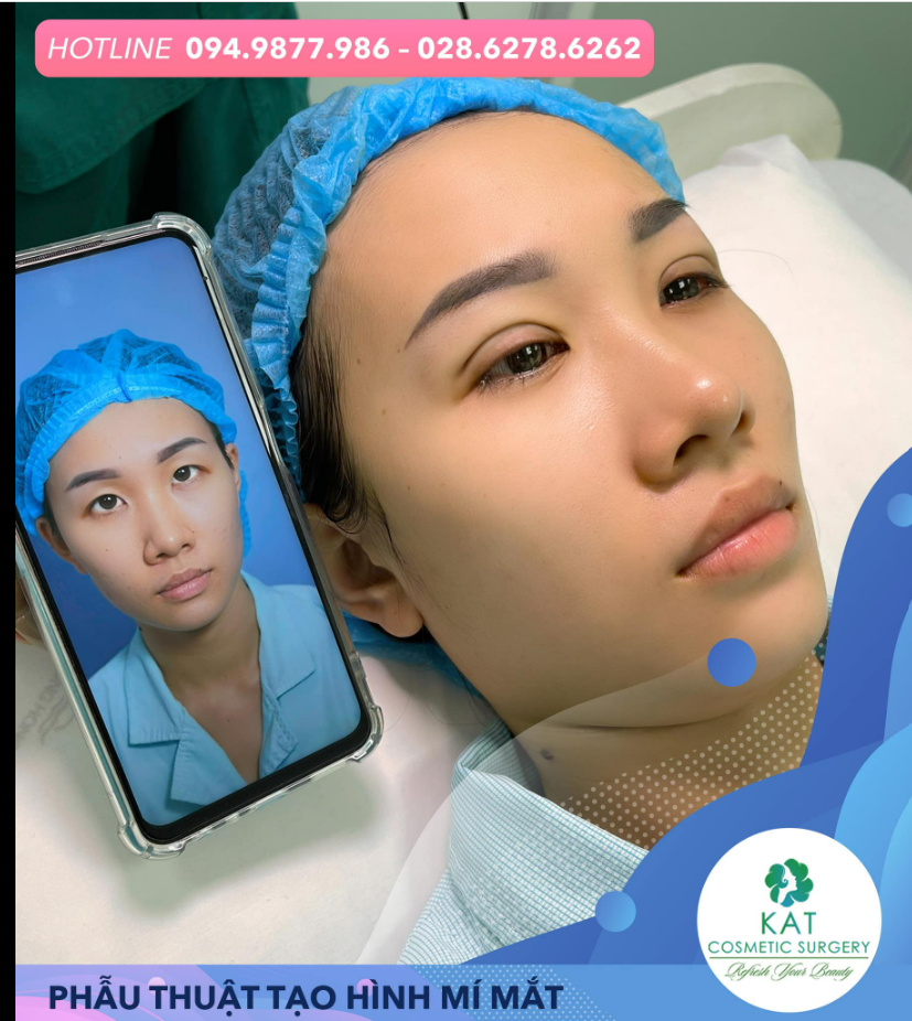 Tích tắc ngay chỉ với 30 phút