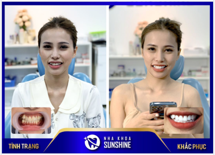 Tiếp thêm 200% cho sự xinh đẹp này