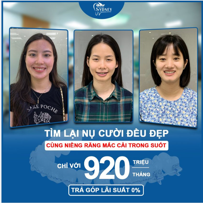 TIẾT KIỆM CHI PHÍ VỚI NIỀNG RĂNG MẮC CÀI TRONG SUỐT
