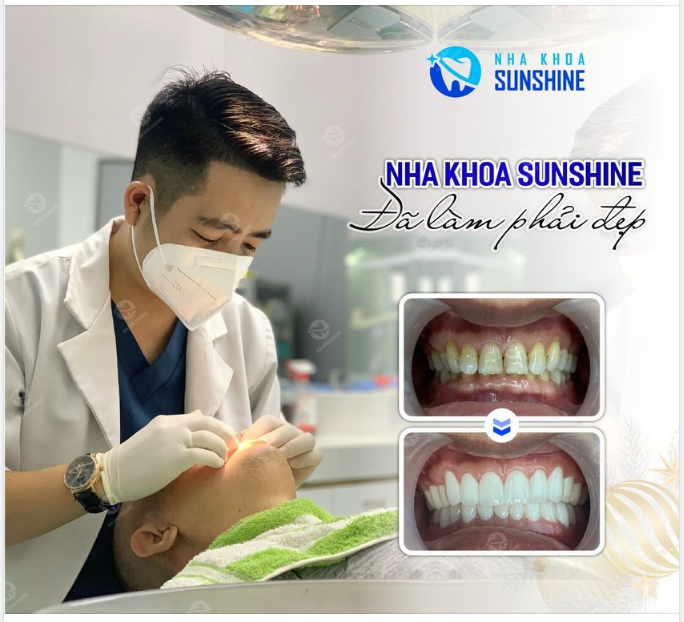 TIN VUI DÀNH CHO NHỮNG AI ĐANG CÓ Ý ĐỊNH LÀM RĂNG SỨ THẨM MỸ