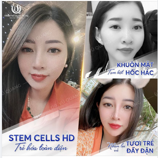 Tới ngay VQ - Nhận luôn 11tr + Trẻ ra 10 tuổi.