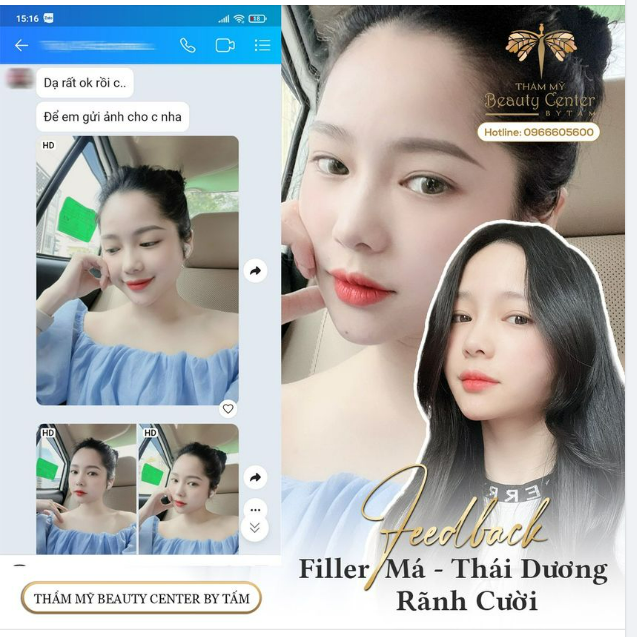 Trăm nghe không bằng 1 feedback