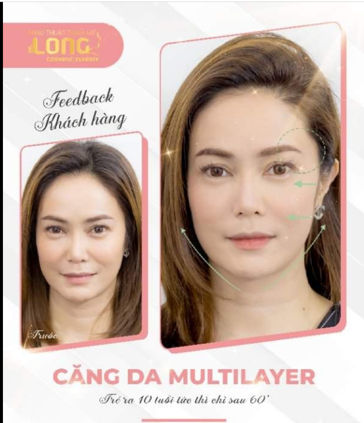 TRẺ RA “CHỤC TUỔI” NHỜ CÔNG NGHỆ SIÊU TOÀN DIỆN