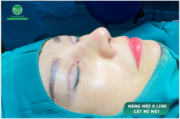 TRẺ TRUNG HƠN - XINH ĐẸP HƠN VỚI COMBO THẦN THÁNH