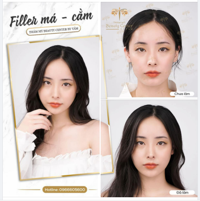 TRỌN NÉT XINH TƯƠI CÙNG FILLER MÁ - CẰM