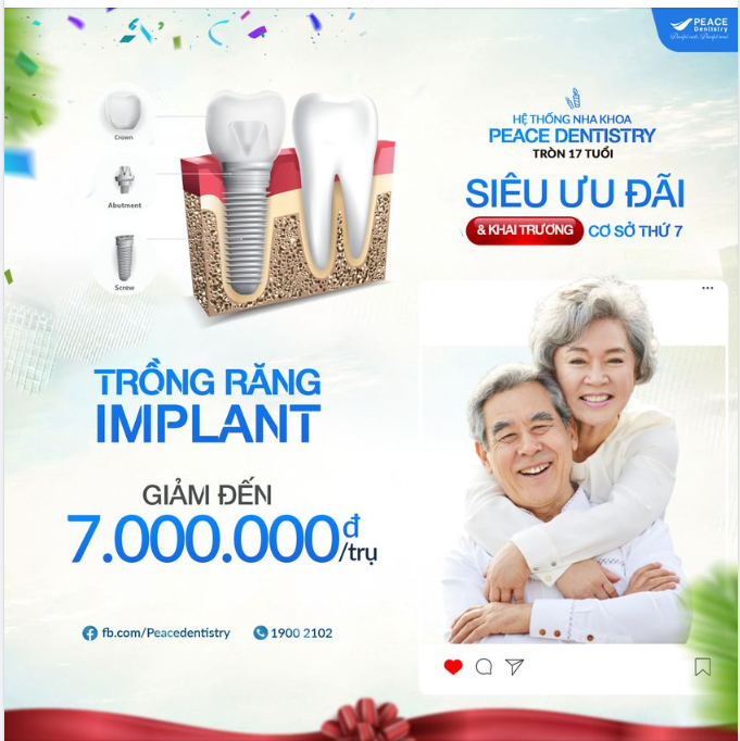 TRỒNG RĂNG IMPLANT CÙNG BÁC SĨ CHUYÊN GIA ĐẦU NGÀNH 