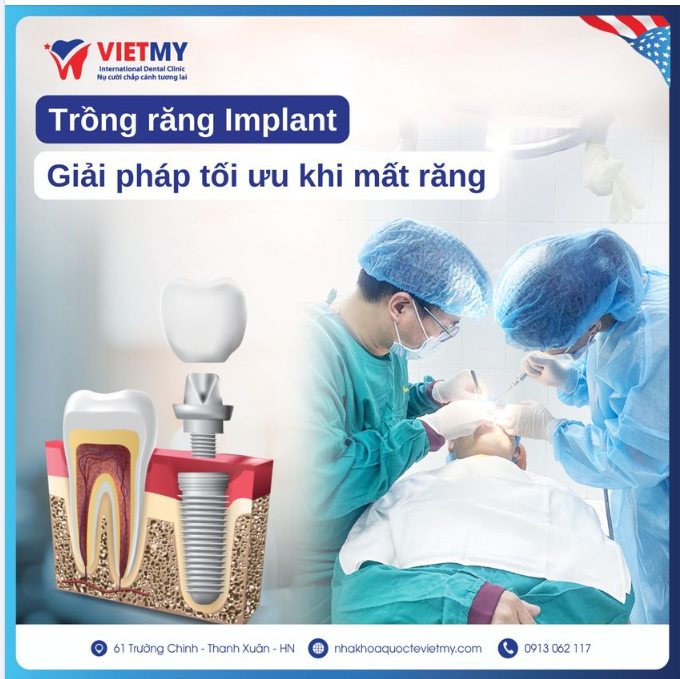 Trồng răng Implant- 6 lợi ích tuyệt vời