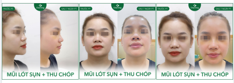 Truyện cổ tích không còn là hư cấu nữa đối với nàng khách của Charming.