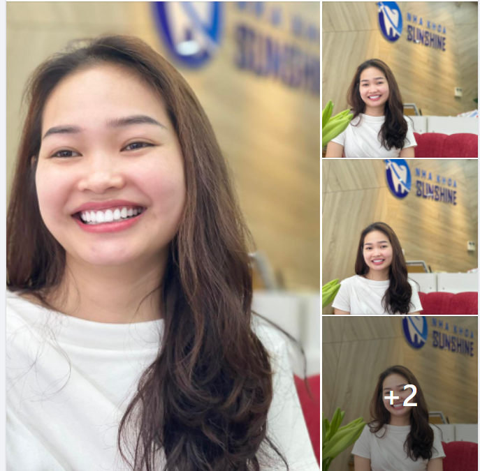 Tự hào là đơn vị dẫn đầu về răng sứ thẩm mỹ