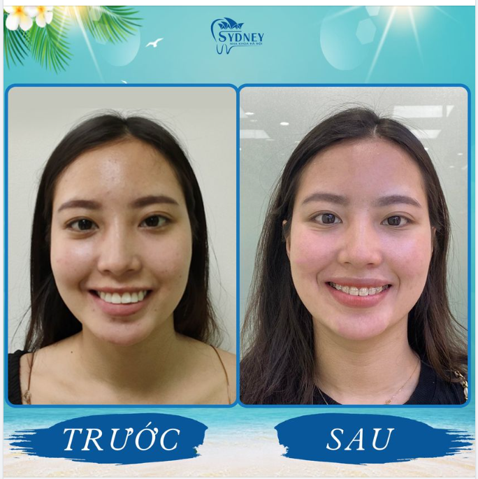 TỪNG CẢI THIỆN NHỎ GIÚP BẠN THAY ĐỔI MỖI NGÀY