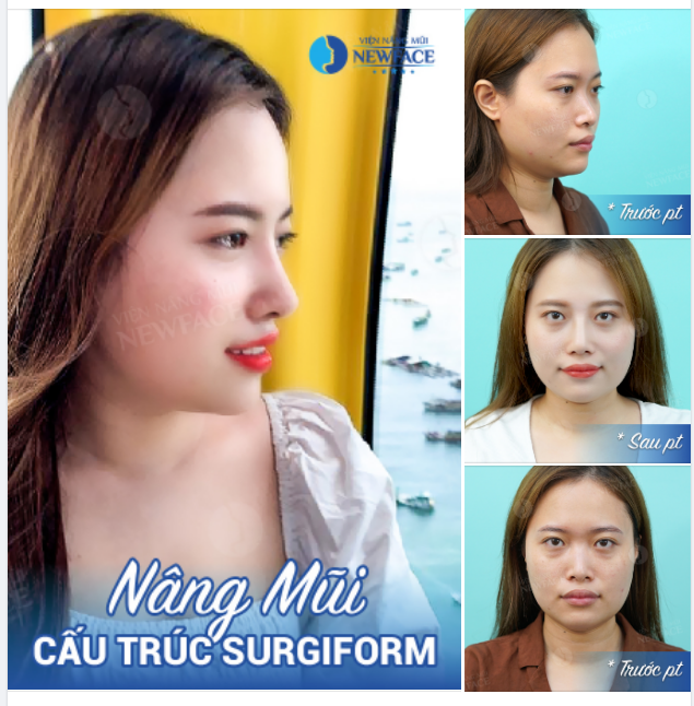 Tuy không phải dân chuyên lý Nhưng em biết em và không khí quan trọng như nhau…!