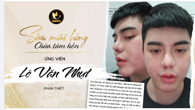 UPDATE ỨNG VIÊN – LÊ VĂN NHỰT