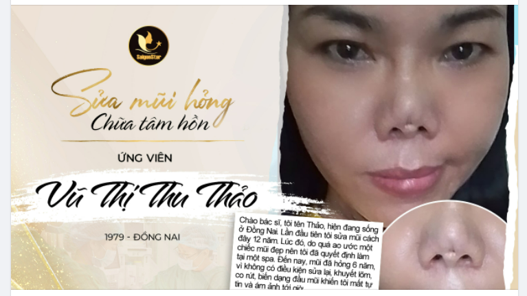 UPDATE ỨNG VIÊN – VŨ THỊ THU THẢO. DR.HOẠT – TÁI SINH NHAN SẮC – VỰC DẬY NIỀM TIN. SỬA MŨI HỎNG – CHỮA TÂM HỒN TIẾP TỤC NHẬN HỒ SƠ