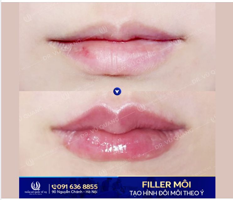 ƯU ĐÃI SỐC Dành cho các bạn