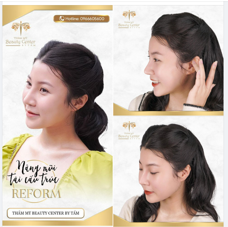 3 ưu điểm tạo nên sức hút không thể cưỡng lại của Nâng mũi Tái Cấu Trúc Reform tại Tấm