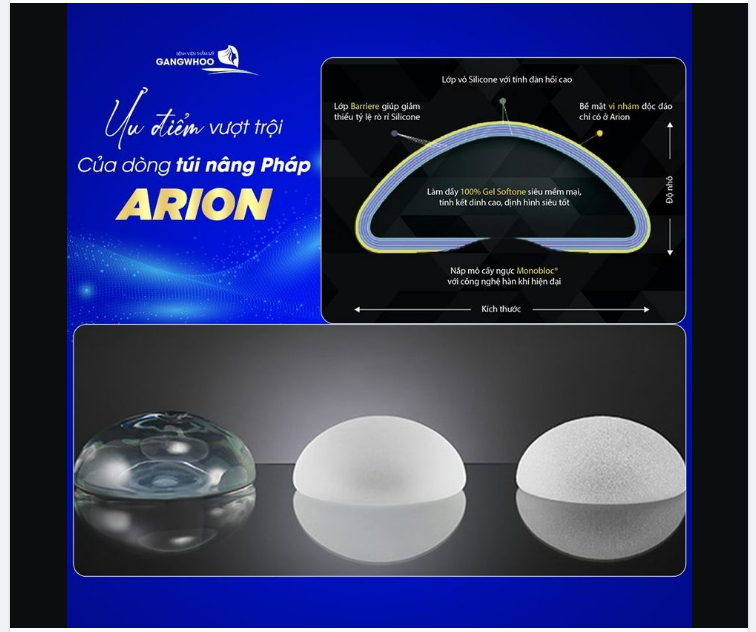 ƯU ĐIỂM VƯỢT TRỘI CỦA DÒNG TÚI VI NHÁM ARION CỦA PHÁP