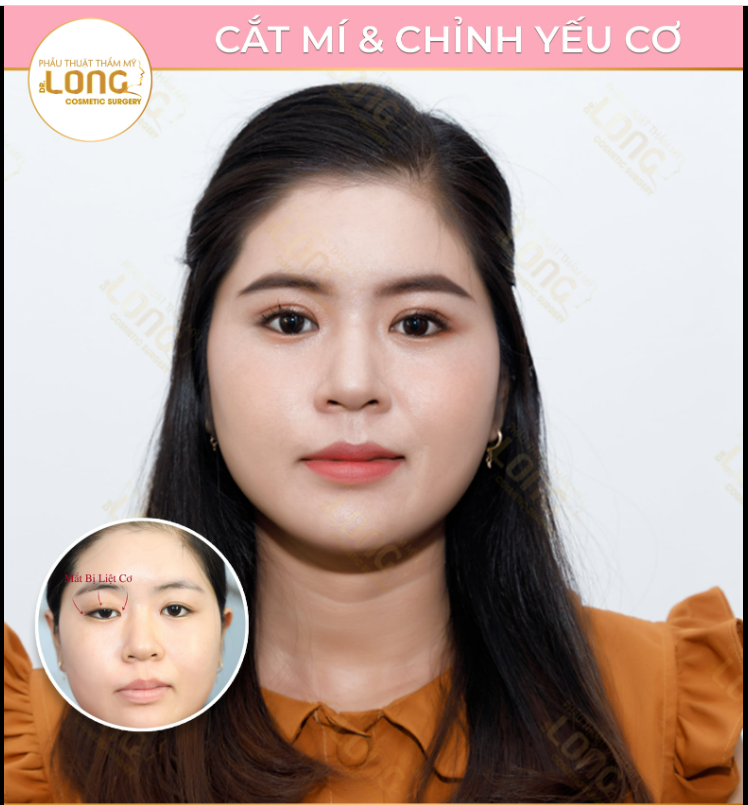 VẪN LÀ GƯƠNG MẶT NÀY NHƯNG NAY LẠ LẮM À NGHEN !!!
