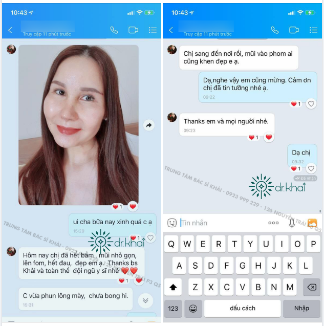 VỀ THUỴ ĐIỂN - AI CÙNG KHEN MŨI VÀO FORM ĐẸP!!
