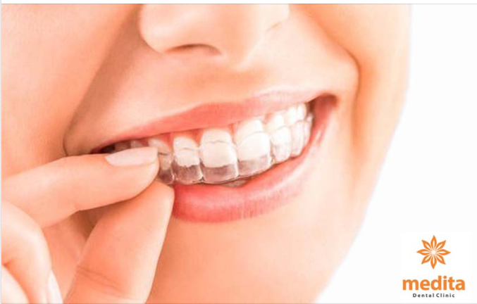 VÌ SAO KHAY NIỀNG TẠO CẢM GIÁC THOẢI MÁI?