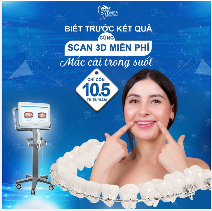 Vì sao mắc cài kim loại được lựa chọn nhiều đến vậy?