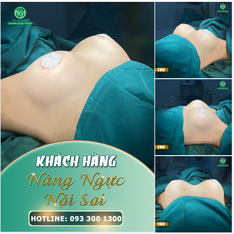 VÒNG 1 ĐẸP CHO KHÁCH HÀNG TỪ NƯỚC NGOÀI XA XÔI