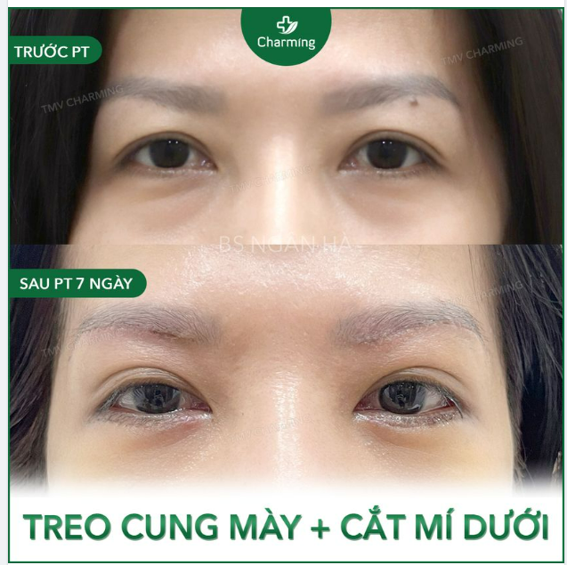 Xăm mày thì đẹp đó, nhưng mỗi tội là cung mày và nét xăm lại chia đôi con đường
