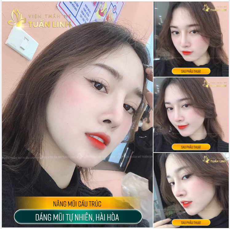 XINH ĐẸP CŨNG LÀ MỘT LOẠI LỰA CHỌN !!!