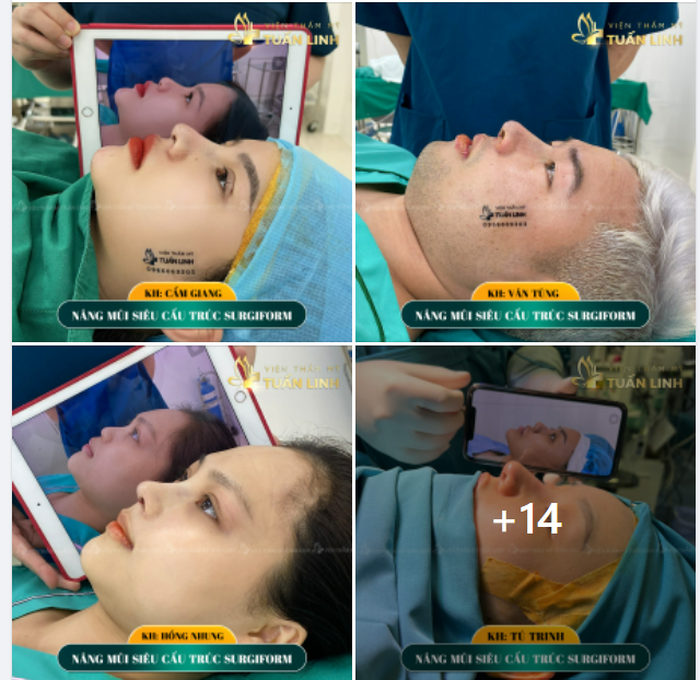 Xinh xuất sắc luôn đó ạ. 100% mọi khuyết điểm của mũi cũ đều được ''dọn sạch'', lên dáng mũi mới chỉ có ''u mê''...