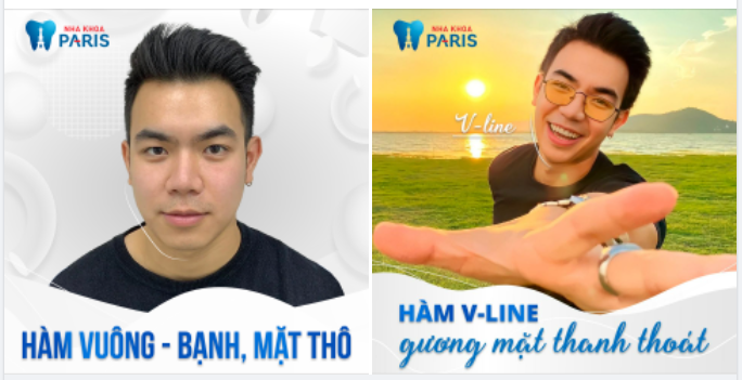  XÓA BỎ HÀM THÔ VUÔNG BẠNH