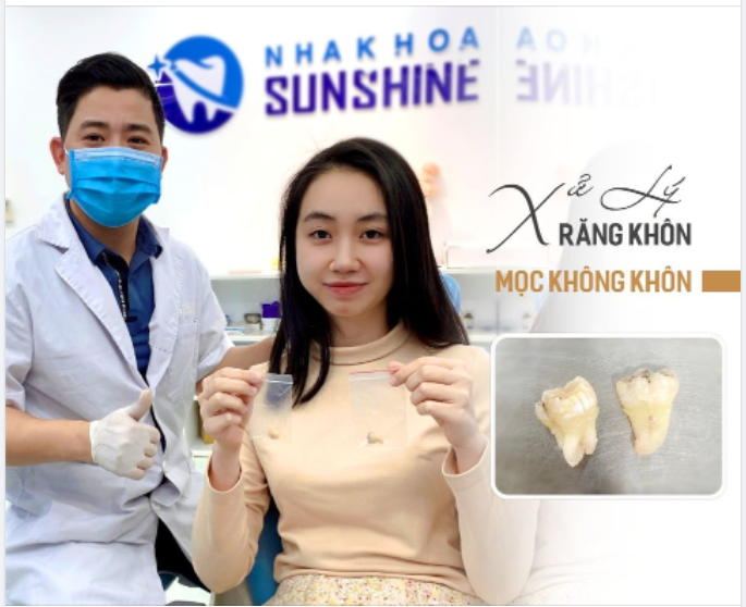 XỬ LÝ RĂNG KHÔN MỌC LỆCH, CHẤM DỨT VIÊM NHIỄM ĐAU NHỨC