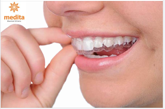 YẾU TỐ QUYẾT ĐỊNH TÍNH HIỆU QUẢ CỦA KHAY NIỀNG