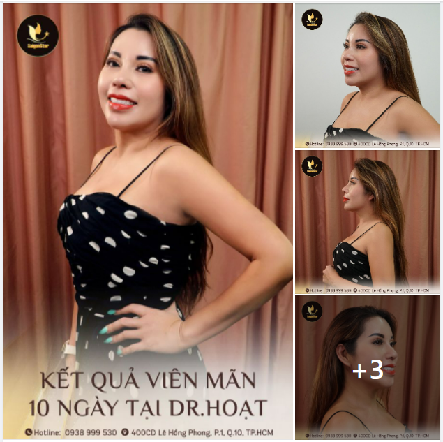 10 NGÀY ĐẸP CÙNG CHỊ ANGIE – VIỆT KIỀU MỸ. KẾT QUẢ CHUYẾN BAY NỬA VÒNG TRÁI ĐẤT