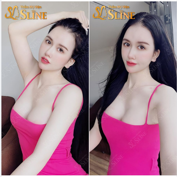 49,9tr ĐỂ SỞ HỮU VÒNG 1 CĂNG TRÒN