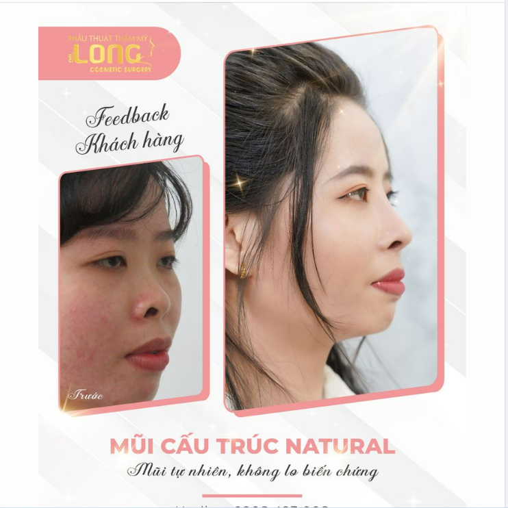 AN TOÀN TỪ LÚC BẮT ĐẦU ĐẾN KHI KẾT THÚC