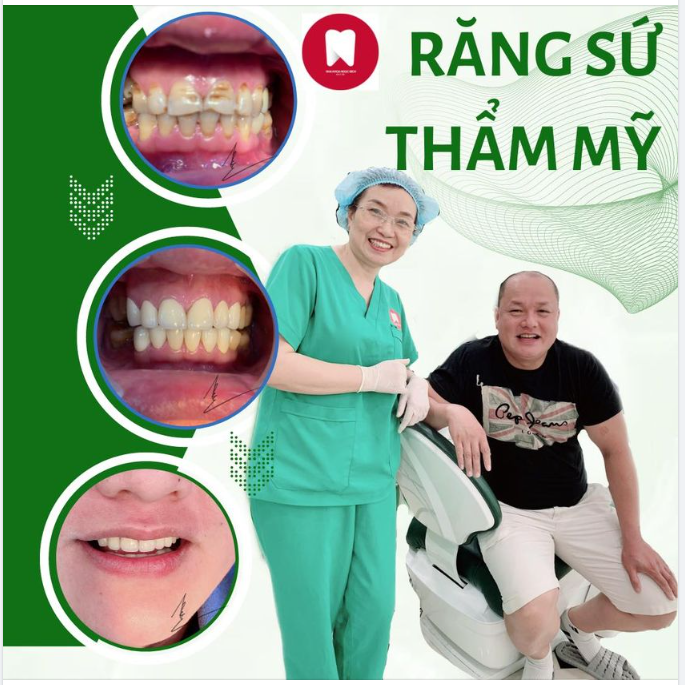 Anh khách hàng Việt kiều Pháp nói “Tôi không nghĩ rằng mình có thể sở hữu 1 hàm răng trắng đẹp, tự nhiên như răng thật thế này” 