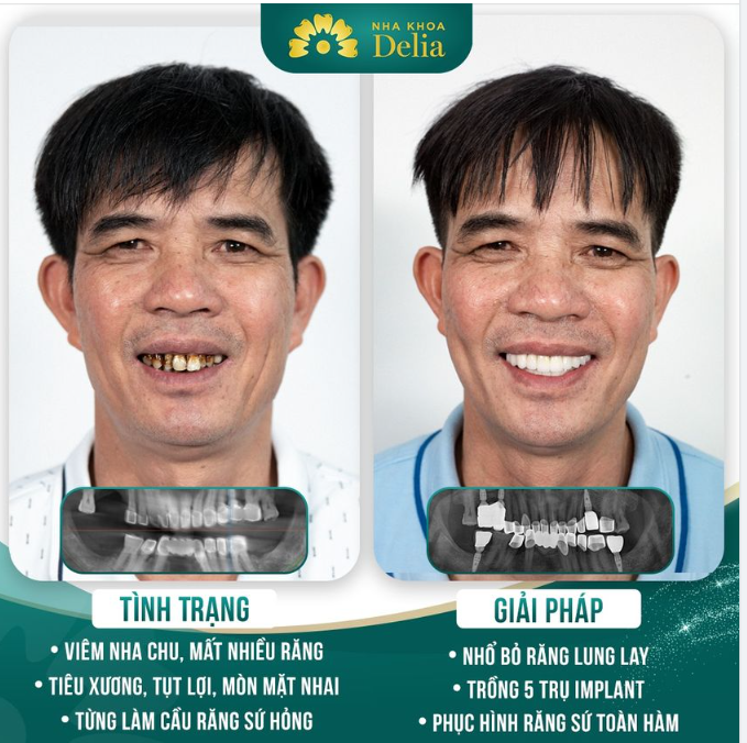 Anh Nguyễn Trung trước khi đến với Delia
