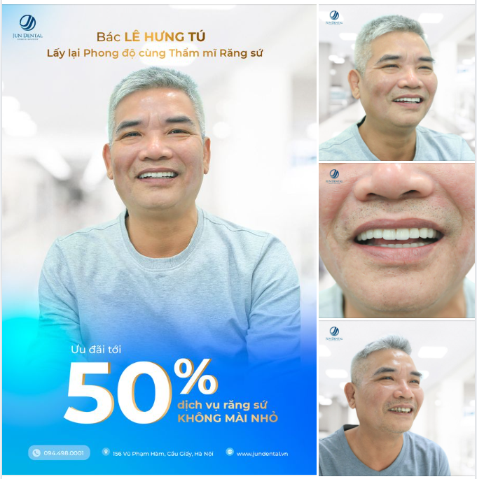 Bác Lê Hưng Tú (sn 1960) là một khách hàng làm 24 răng sứ Zirconia, Đức tại Nha Khoa Thẩm Mỹ Quốc Tế Jun Dental đem lại kết quả rất tốt.