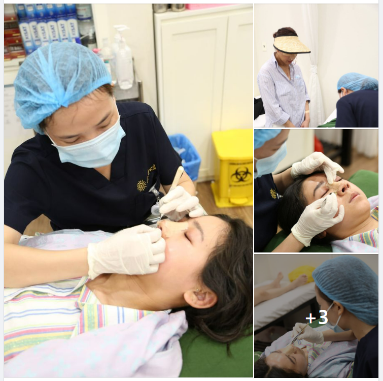 BÁC SĨ KHAI ĐỖ QUANG THỰC HIỆN MŨI CẤU TRÚC CHO 2 KHÁCH HÀNG TỪ ÚC.